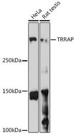 TRRAP Antibody in Western Blot (WB)