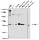 EPHX2 Antibody in Western Blot (WB)