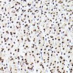 RAD21 Antibody in Immunohistochemistry (Paraffin) (IHC (P))