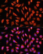 RhoG Antibody in Immunocytochemistry (ICC/IF)