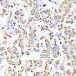 RhoG Antibody in Immunohistochemistry (Paraffin) (IHC (P))