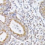 RhoG Antibody in Immunohistochemistry (Paraffin) (IHC (P))