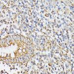 RhoG Antibody in Immunohistochemistry (Paraffin) (IHC (P))