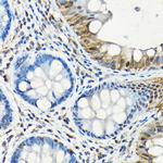 SMAD5 Antibody in Immunohistochemistry (Paraffin) (IHC (P))