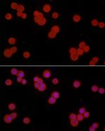 S100A10 Antibody in Immunocytochemistry (ICC/IF)