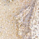 S100A10 Antibody in Immunohistochemistry (Paraffin) (IHC (P))