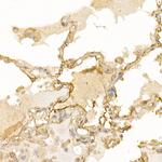 S100A10 Antibody in Immunohistochemistry (Paraffin) (IHC (P))