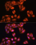 PHGDH Antibody in Immunocytochemistry (ICC/IF)