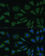 CDw293 Antibody in Immunocytochemistry (ICC/IF)