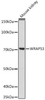 WRAP53 Antibody in Western Blot (WB)