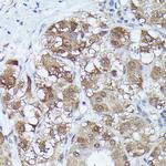 MT2A Antibody in Immunohistochemistry (Paraffin) (IHC (P))