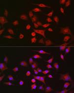 LLGL1 Antibody in Immunocytochemistry (ICC/IF)