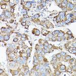 LLGL1 Antibody in Immunohistochemistry (Paraffin) (IHC (P))