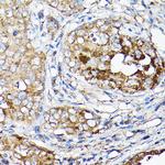 LLGL1 Antibody in Immunohistochemistry (Paraffin) (IHC (P))