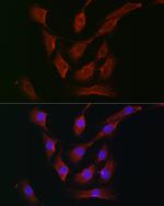 RSK1/RSK2/RSK3 Antibody in Immunocytochemistry (ICC/IF)