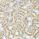 RSK1/RSK2/RSK3 Antibody in Immunohistochemistry (Paraffin) (IHC (P))