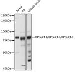 RSK1/RSK2/RSK3 Antibody in Western Blot (WB)