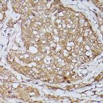 ZIP11 Antibody in Immunohistochemistry (Paraffin) (IHC (P))