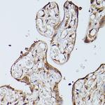 ZIP11 Antibody in Immunohistochemistry (Paraffin) (IHC (P))