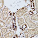 ZIP11 Antibody in Immunohistochemistry (Paraffin) (IHC (P))