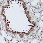 ZIP11 Antibody in Immunohistochemistry (Paraffin) (IHC (P))