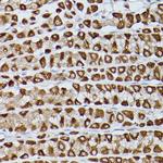 ZIP11 Antibody in Immunohistochemistry (Paraffin) (IHC (P))