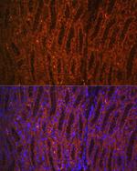 PCK1 Antibody in Immunohistochemistry (Paraffin) (IHC (P))