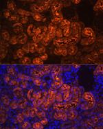 PCK1 Antibody in Immunohistochemistry (Paraffin) (IHC (P))