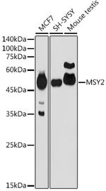 YBX2 Antibody in Western Blot (WB)