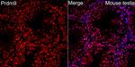 PRDM9 Antibody in Immunocytochemistry (ICC/IF)