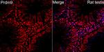 PRDM9 Antibody in Immunocytochemistry (ICC/IF)