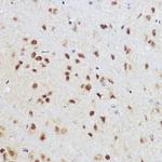 KLF12 Antibody in Immunohistochemistry (Paraffin) (IHC (P))