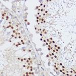 KLF12 Antibody in Immunohistochemistry (Paraffin) (IHC (P))