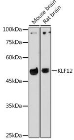 KLF12 Antibody in Western Blot (WB)