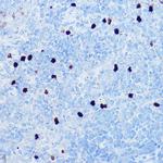 S100A8 Antibody in Immunohistochemistry (Paraffin) (IHC (P))