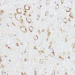 NEURL1B Antibody in Immunohistochemistry (Paraffin) (IHC (P))