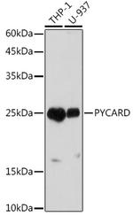 PYCARD Antibody in Western Blot (WB)