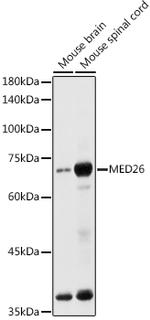 MED26 Antibody in Western Blot (WB)