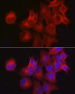 CDKN3 Antibody in Immunocytochemistry (ICC/IF)