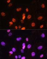 FANCD2 Antibody in Immunocytochemistry (ICC/IF)