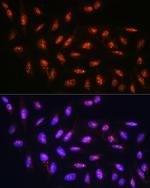 FANCD2 Antibody in Immunocytochemistry (ICC/IF)