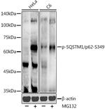 Phospho-SQSTM1 (Ser349) Antibody in Western Blot (WB)