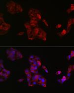 IGF2 Antibody in Immunocytochemistry (ICC/IF)