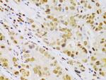 IKK beta Antibody in Immunohistochemistry (Paraffin) (IHC (P))