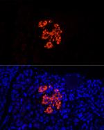 Insulin Antibody in Immunocytochemistry (ICC/IF)