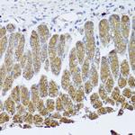 TrkA Antibody in Immunohistochemistry (Paraffin) (IHC (P))