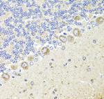 TrkA Antibody in Immunohistochemistry (Paraffin) (IHC (P))