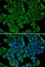 REG3G Antibody in Immunocytochemistry (ICC/IF)