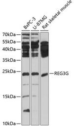 REG3G Antibody in Western Blot (WB)