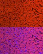 CYP2E1 Antibody in Immunocytochemistry (ICC/IF)